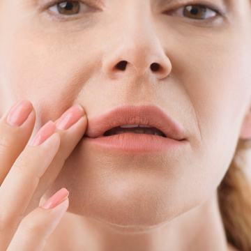 JUVÉDERM® Ultra Plus XC