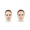 JUVÉDERM® Ultra Plus XC (2 options) NOBD