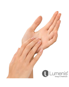 Hand Rejuvenation with Radiesse and Intense Pulsed Light